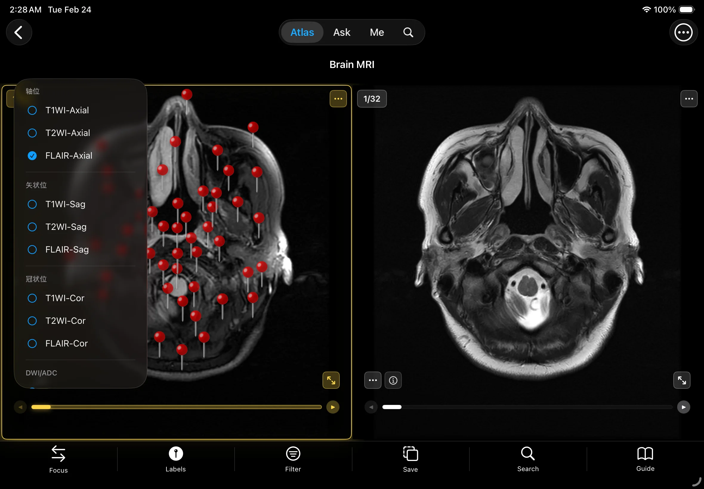 Complete Sequences with Thin Slices