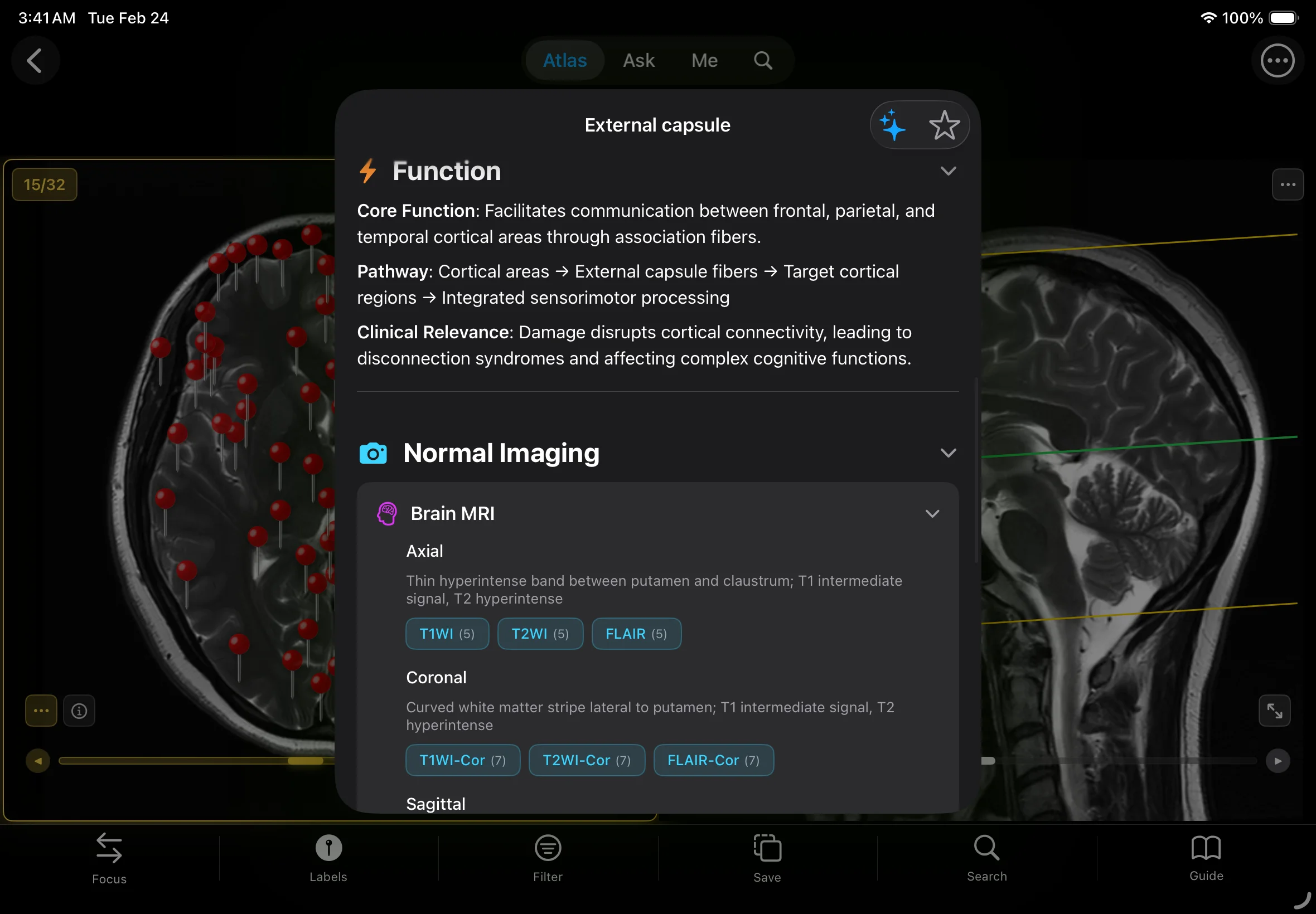 Complete Anatomical Annotations