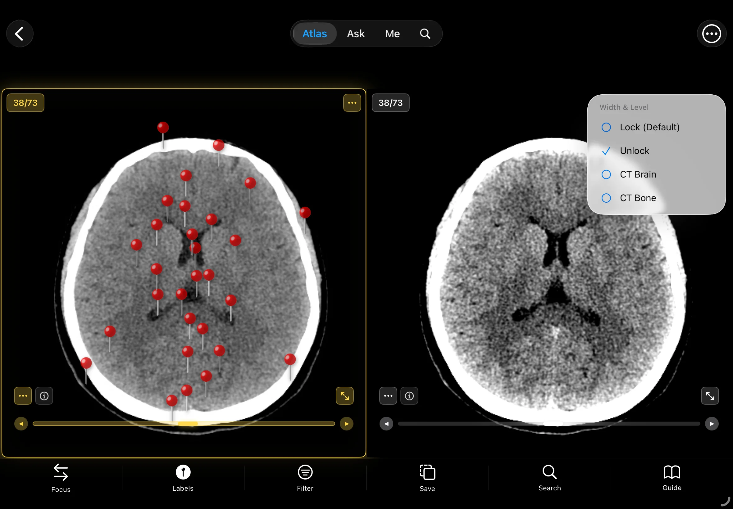 Adjustable Window Width/Level